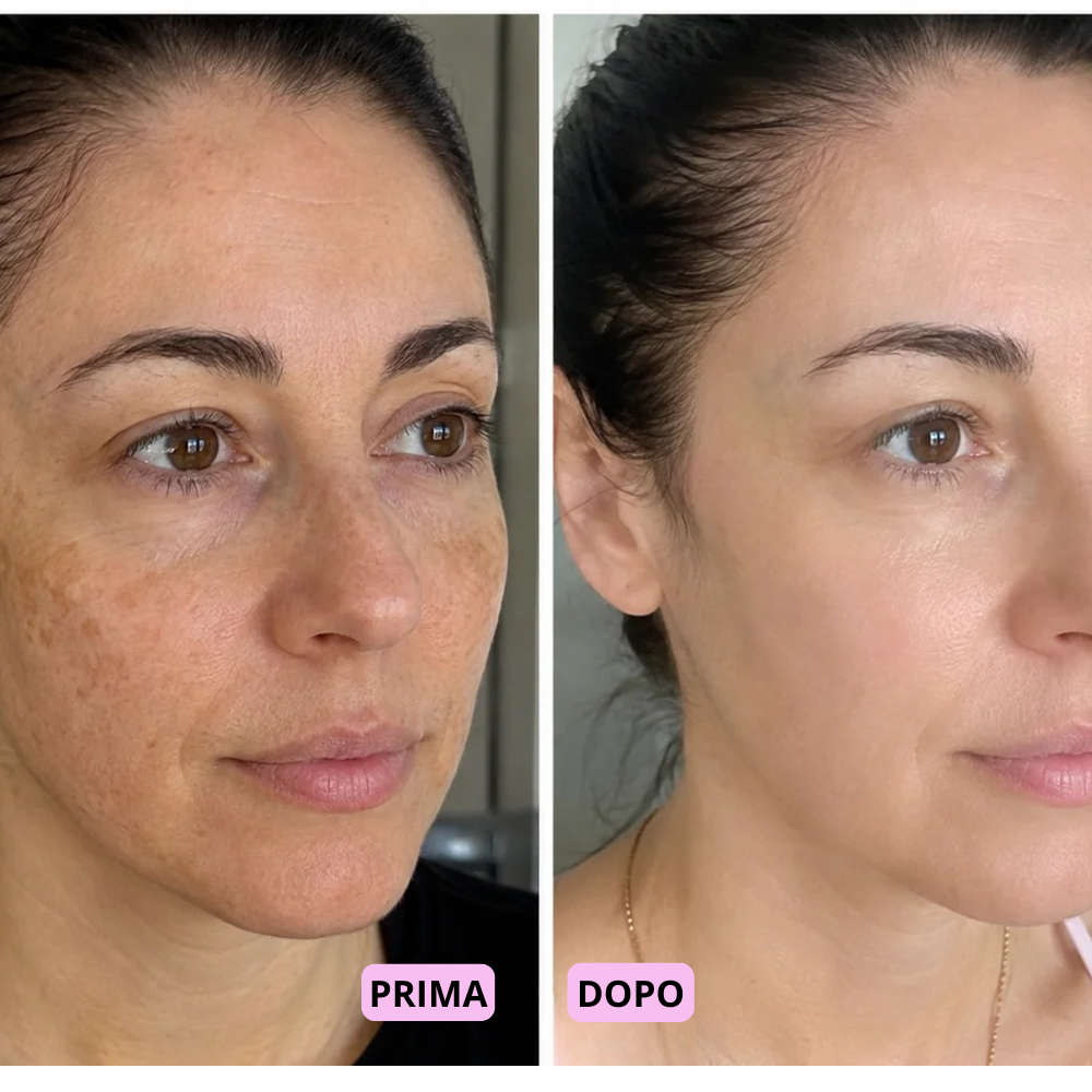 Maschera al Collagene con Acido Kojico e Curcuma