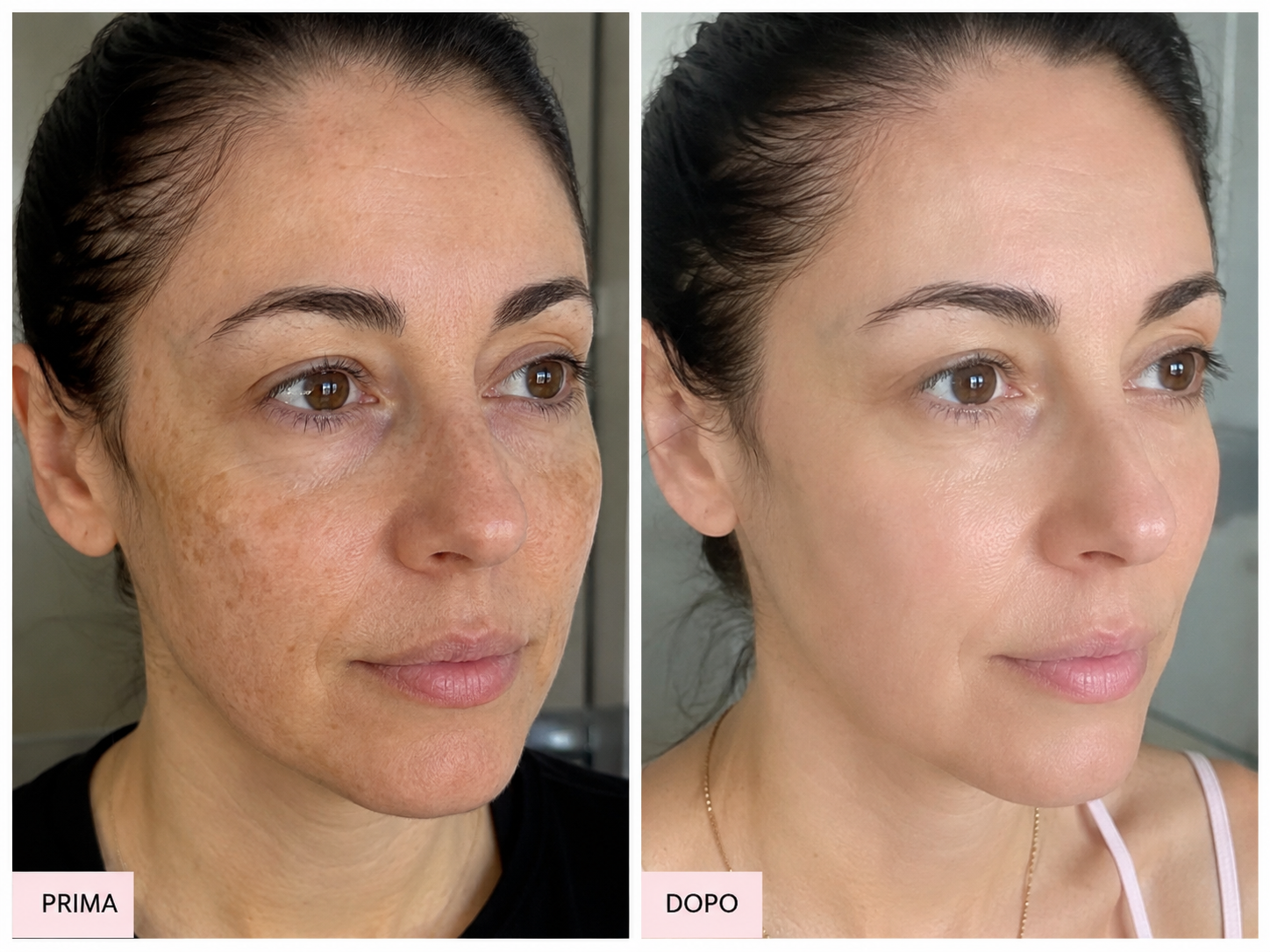 Maschera al Collagene con Acido Kojico e Curcuma